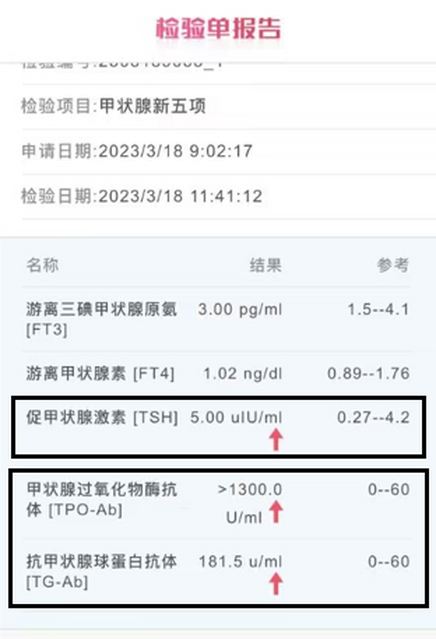 甲功五项化验单图片