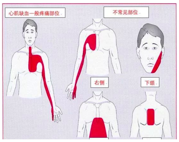 心前区位置胸前图片