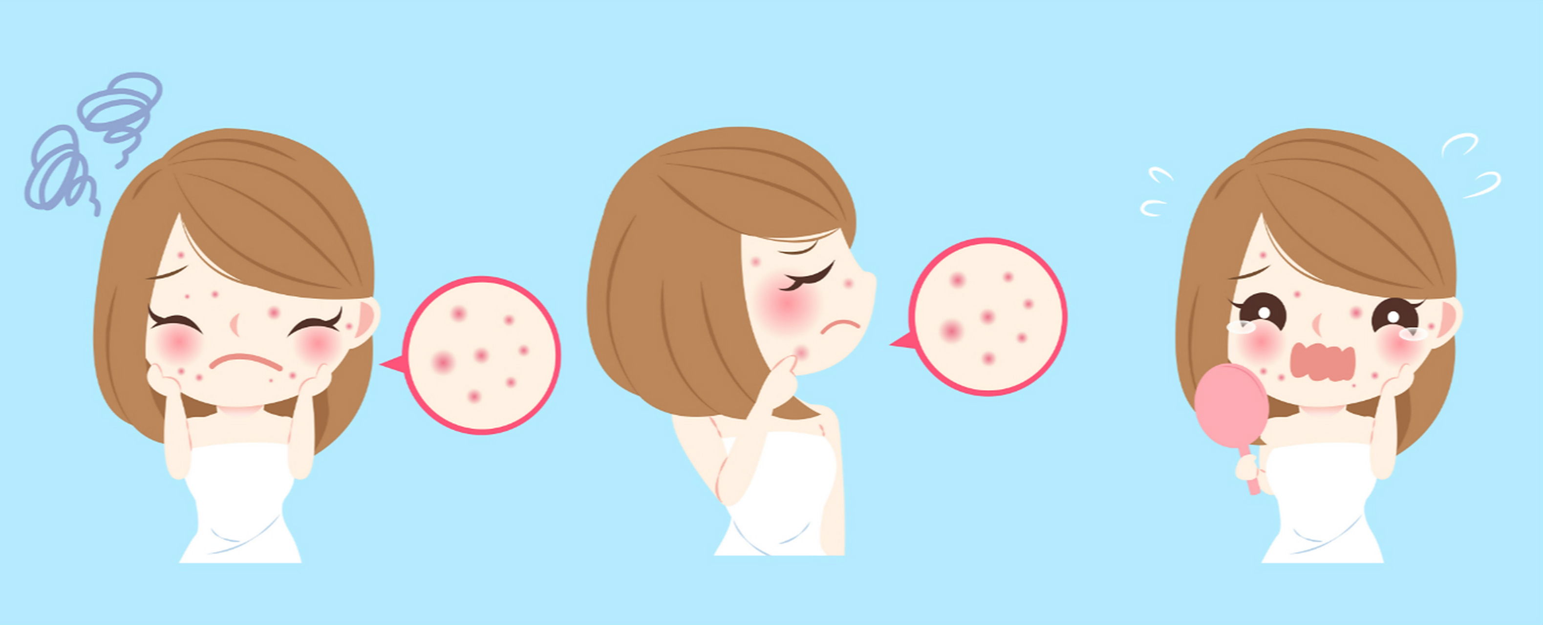 痘坑的症状不太严重,能自行恢复,对于比较严重的痘坑