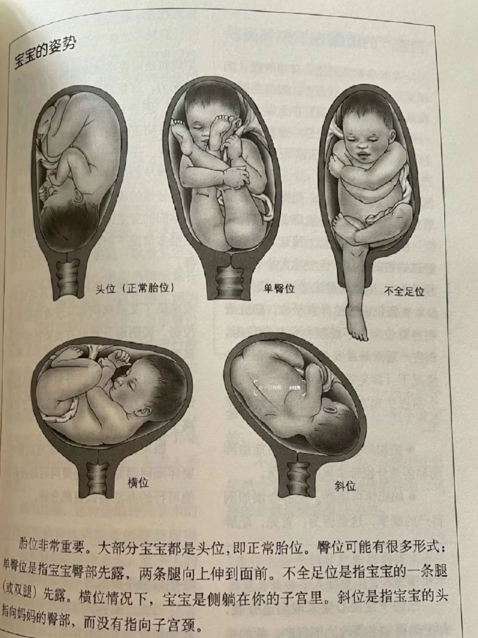 生孩子就像是开盲盒一位朋友怀孕到生都是臀位[失望r]愿所有麻麻们都