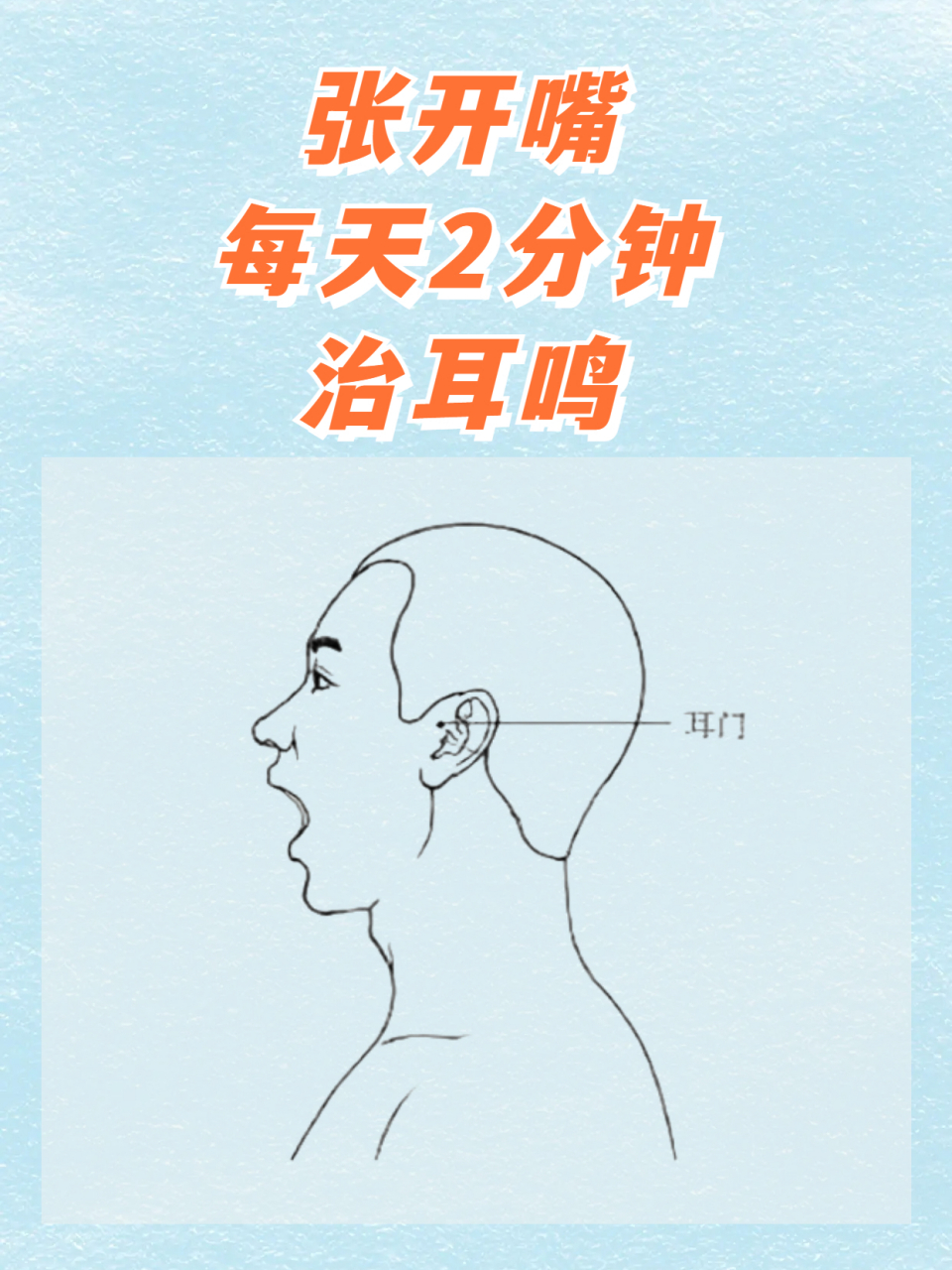 当患者张嘴时,在耳屏前可以摸到一个明显的凹陷,而耳门穴就在这个凹陷