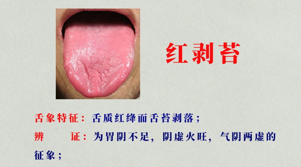 为什么会有舌苔