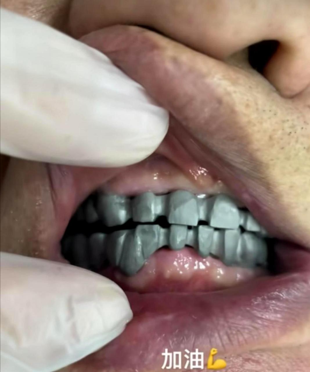 这是装铁牙吗?如果咬到舌头,那一定会非常疼!