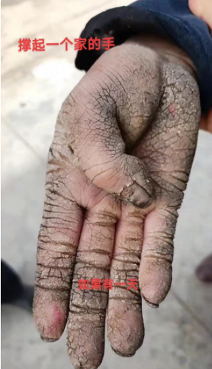 这就是撑起一个家的手,这就是劳动人民的手,如果这是我老公,我会一