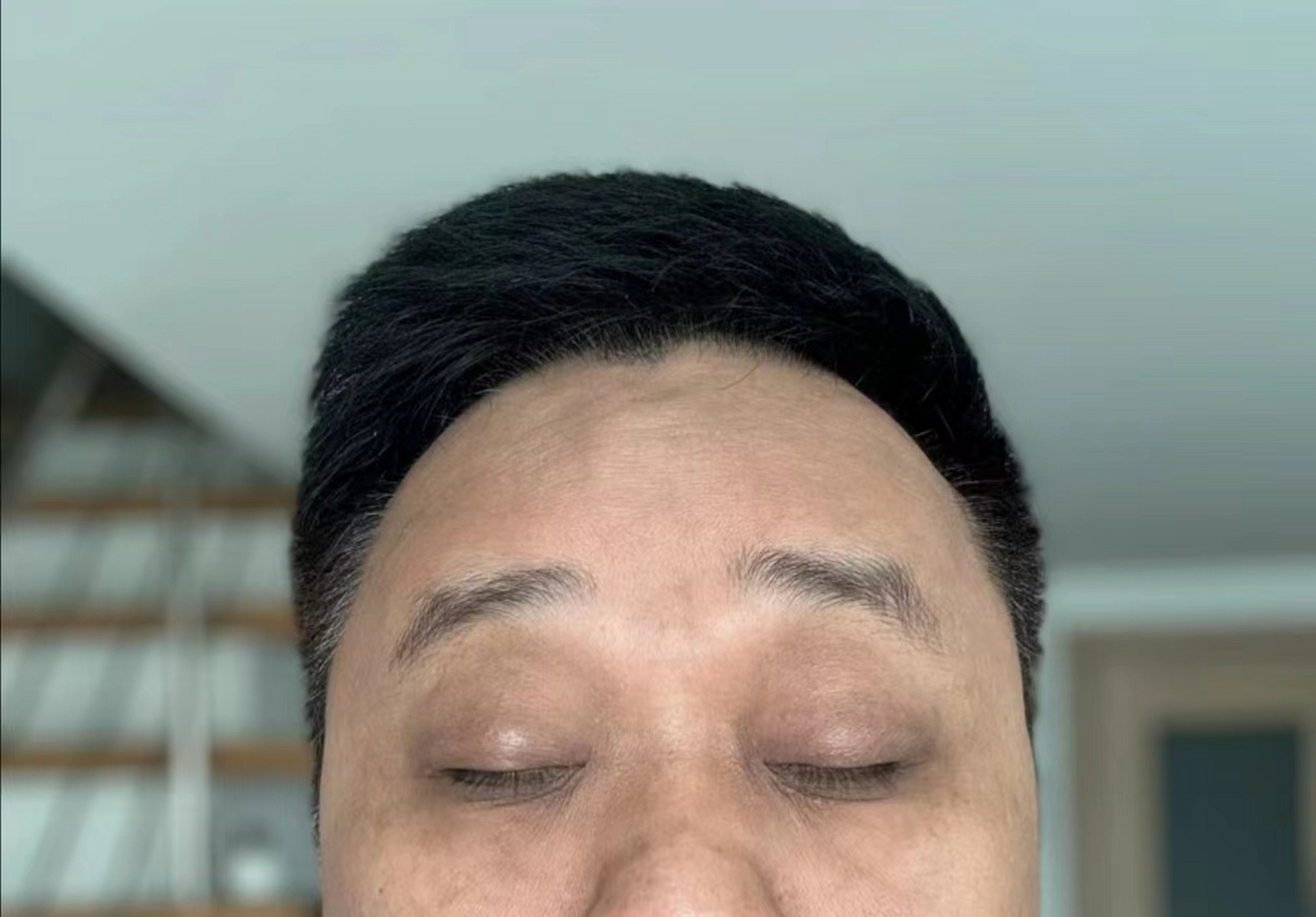 眼圈发黑只是因为睡眠不足吗?不是,这也可能是肝脏给你的提示.