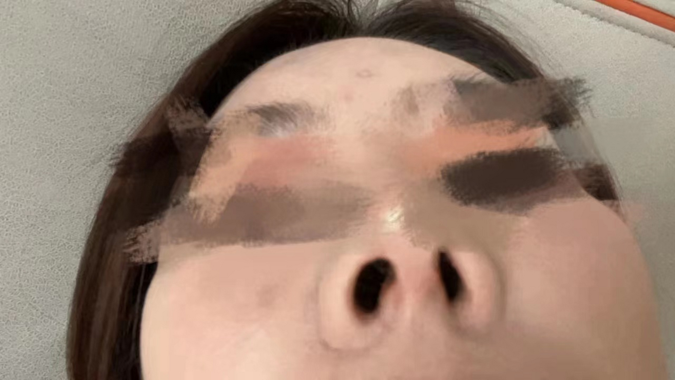 上海李国珍,鼻子失败,鼻子一大一小  鼻子已经被李国珍做的彻底失败了