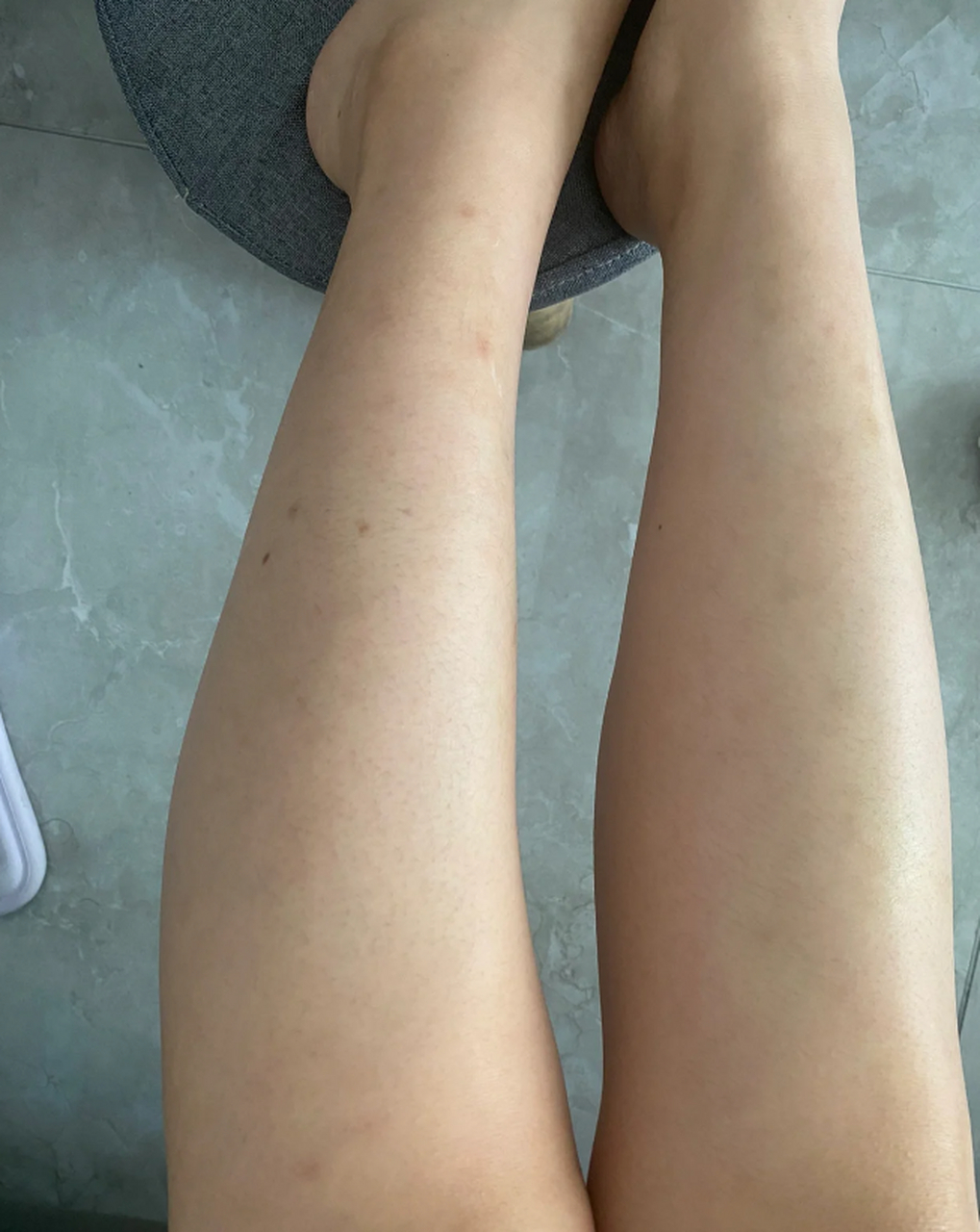 皮肤黑色素沉淀是许多人面临的皮肤问题之一,但并不是无法解决的.