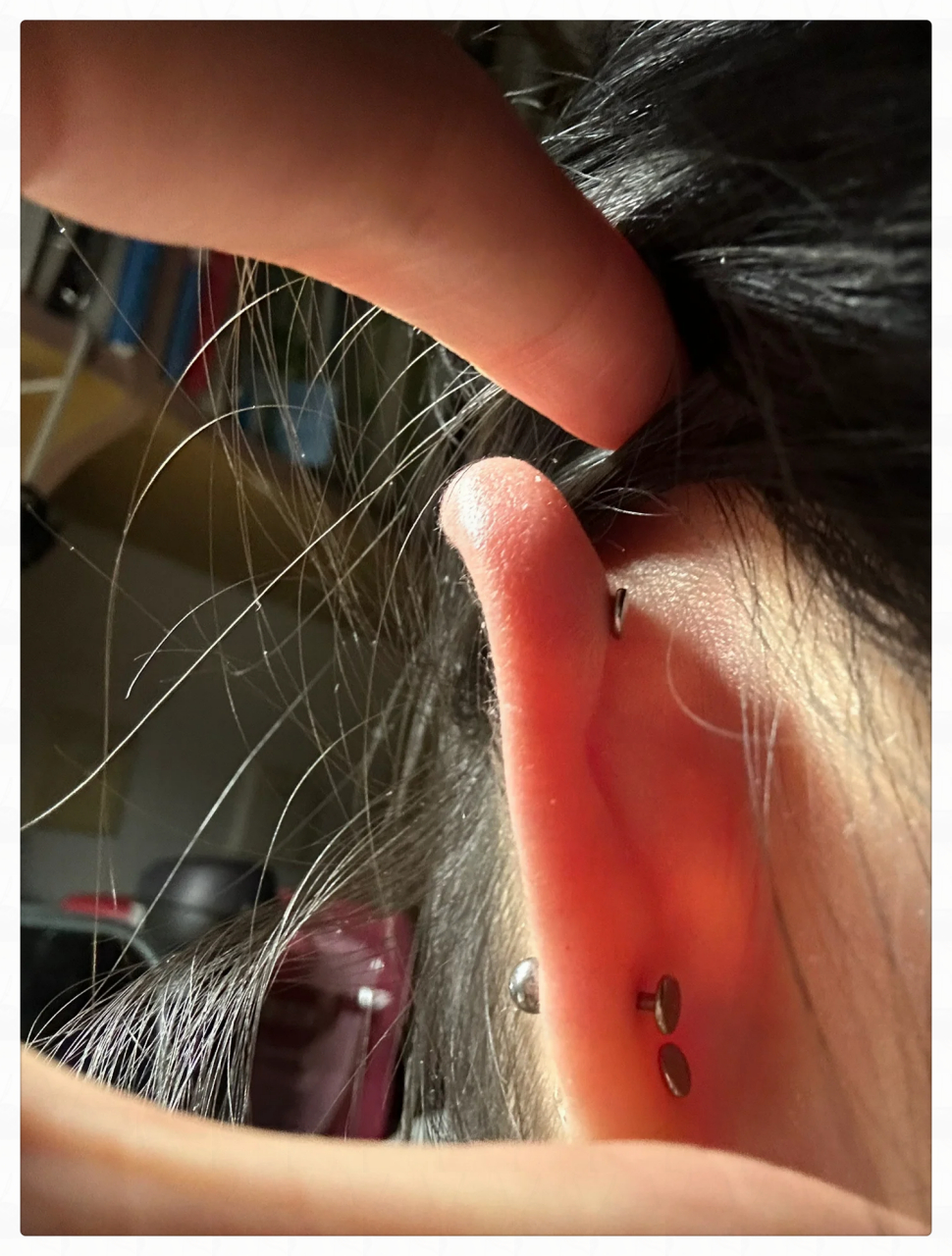 了一段时间后维多出现了小小的鼓包,家人们,想问问这种算不算增生了啊