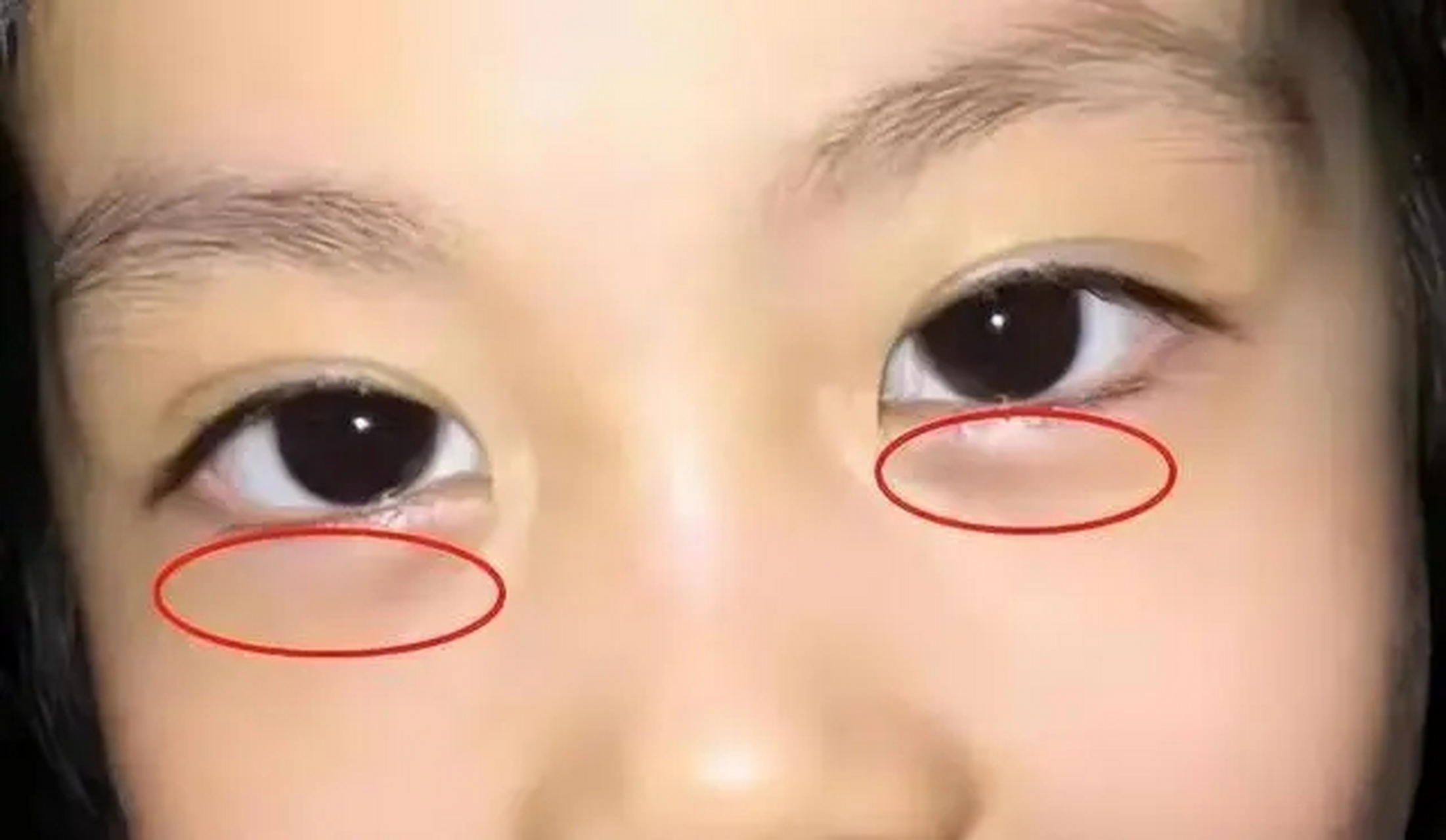 可以观察脸上这几个 方面: 1看2黄 头发黄而少,是脾虚 脸色黄而没光