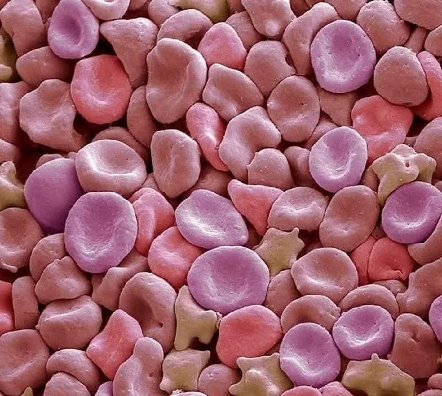 红细胞在显微镜下是什么样子?[尬笑]