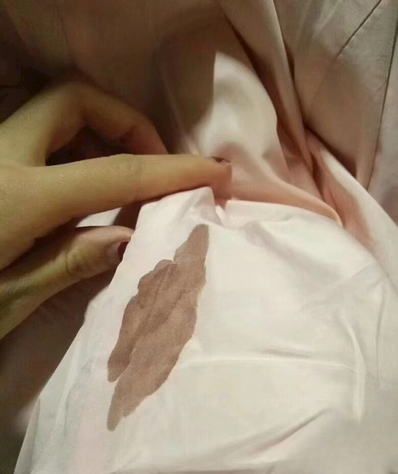 4cm,每天难受肚子疼,一来月经就发愁,经量大不说
