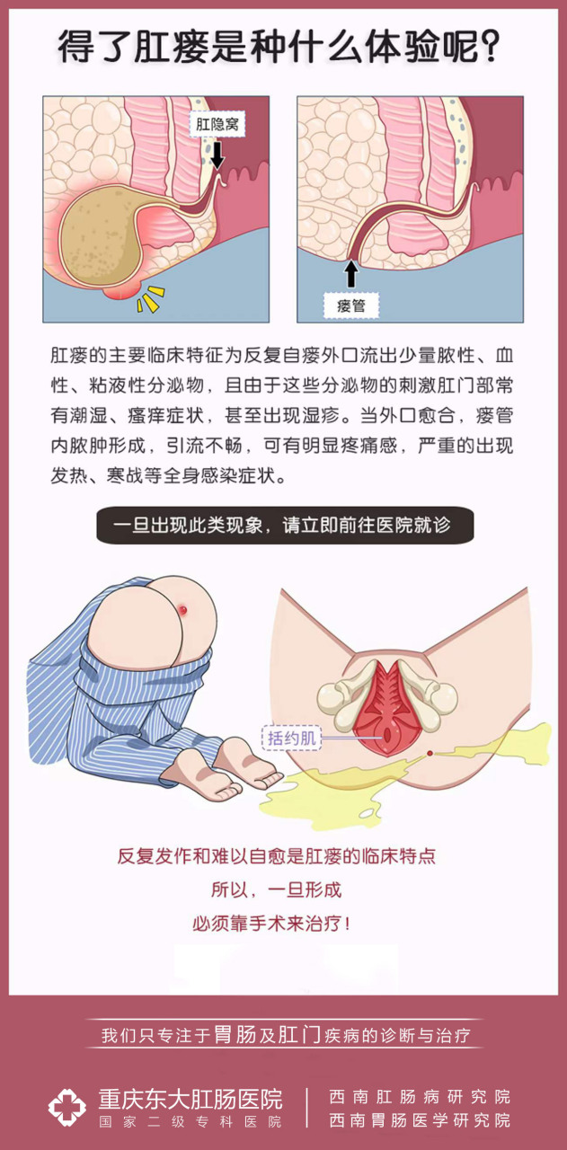 肛门旁边长硬包图片