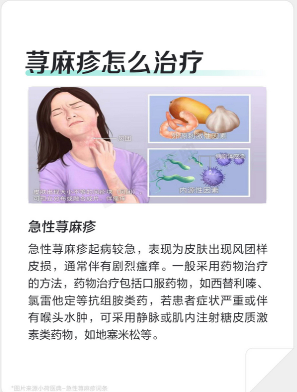 荨麻疹怎么治疗才能断根?