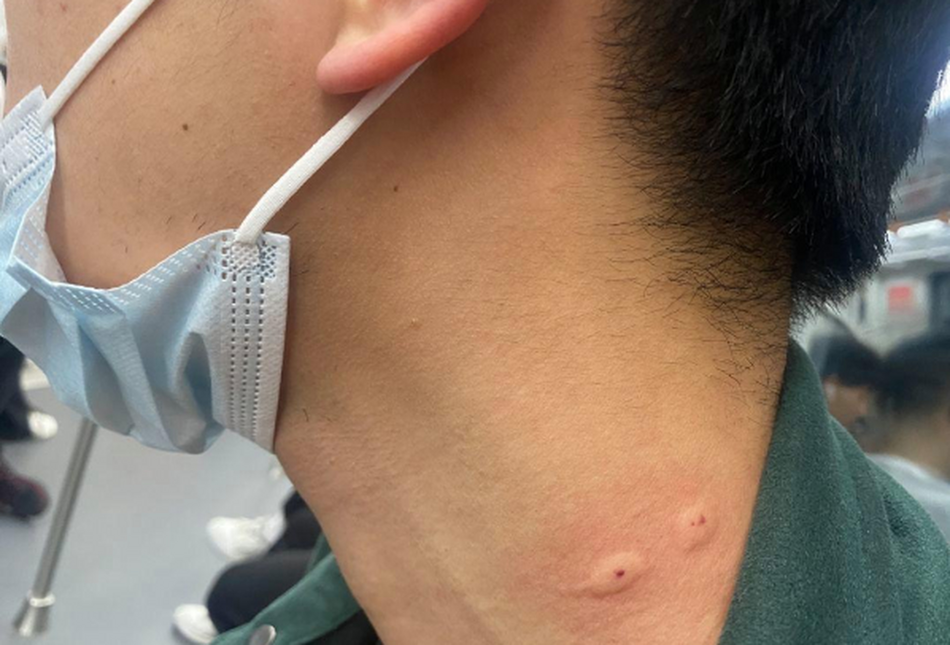 有谁知道这是啥虫嘛?被咬了,好疼