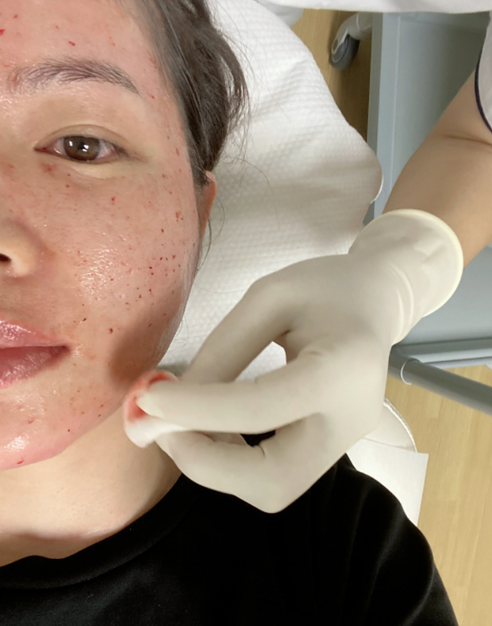 手打水光针是一种受欢迎的美容注射技术,通过微小的注射器具将透明质