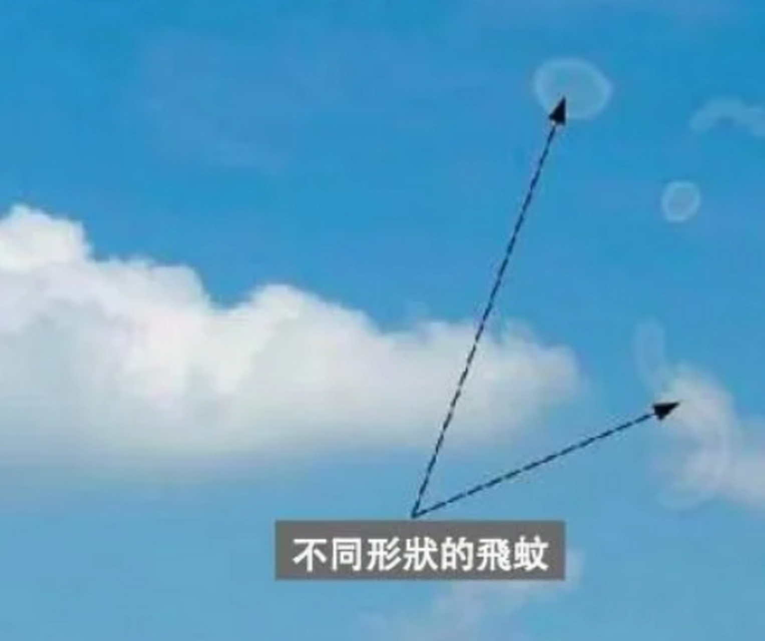 40年眼科医生告诉你1个治飞蚊症的中成药 感觉眼前有黑影,像小蚊子一