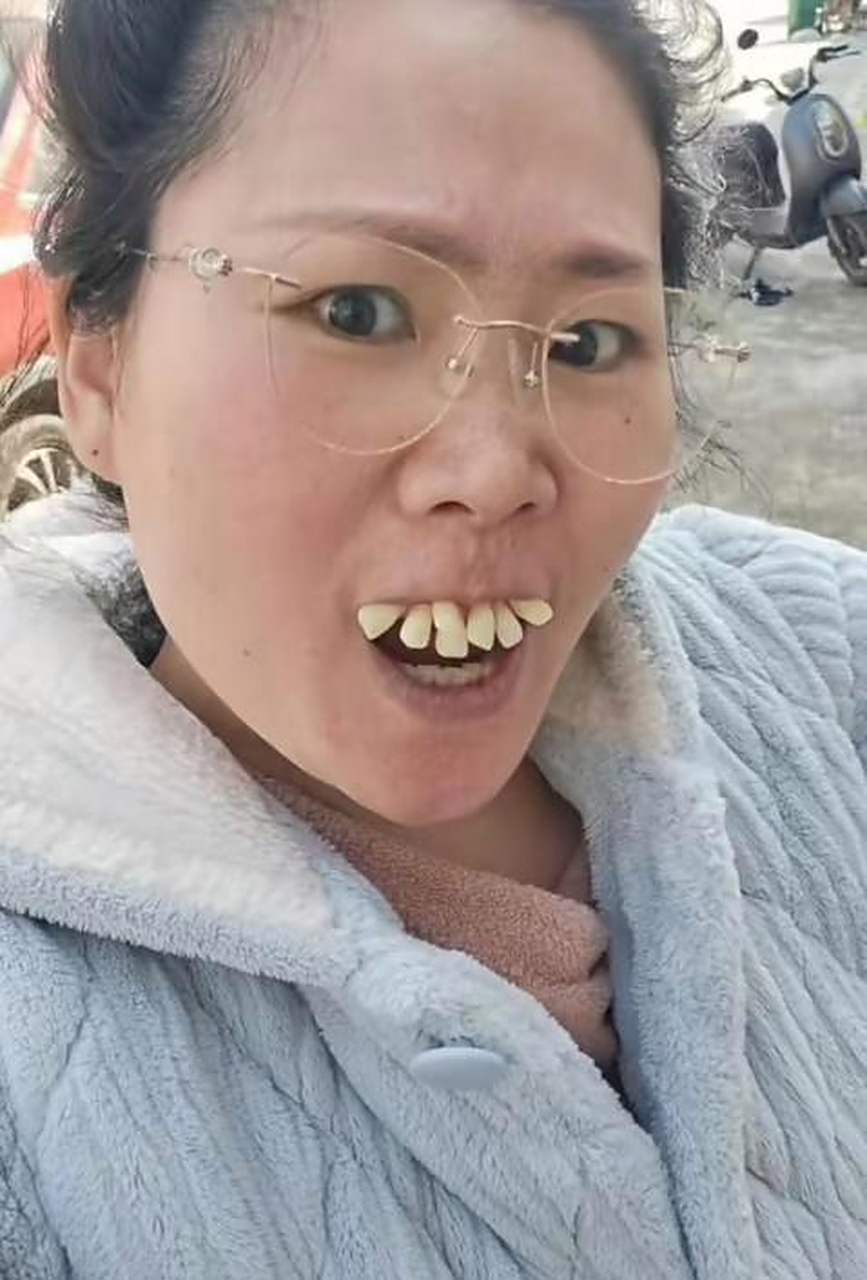 牙齿长这么歪为什么不去矫正?