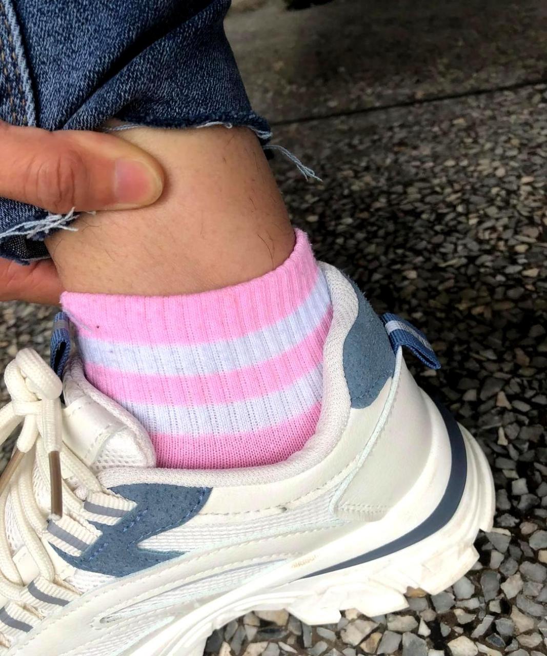 女孩子长这么多腿毛,是否正常?