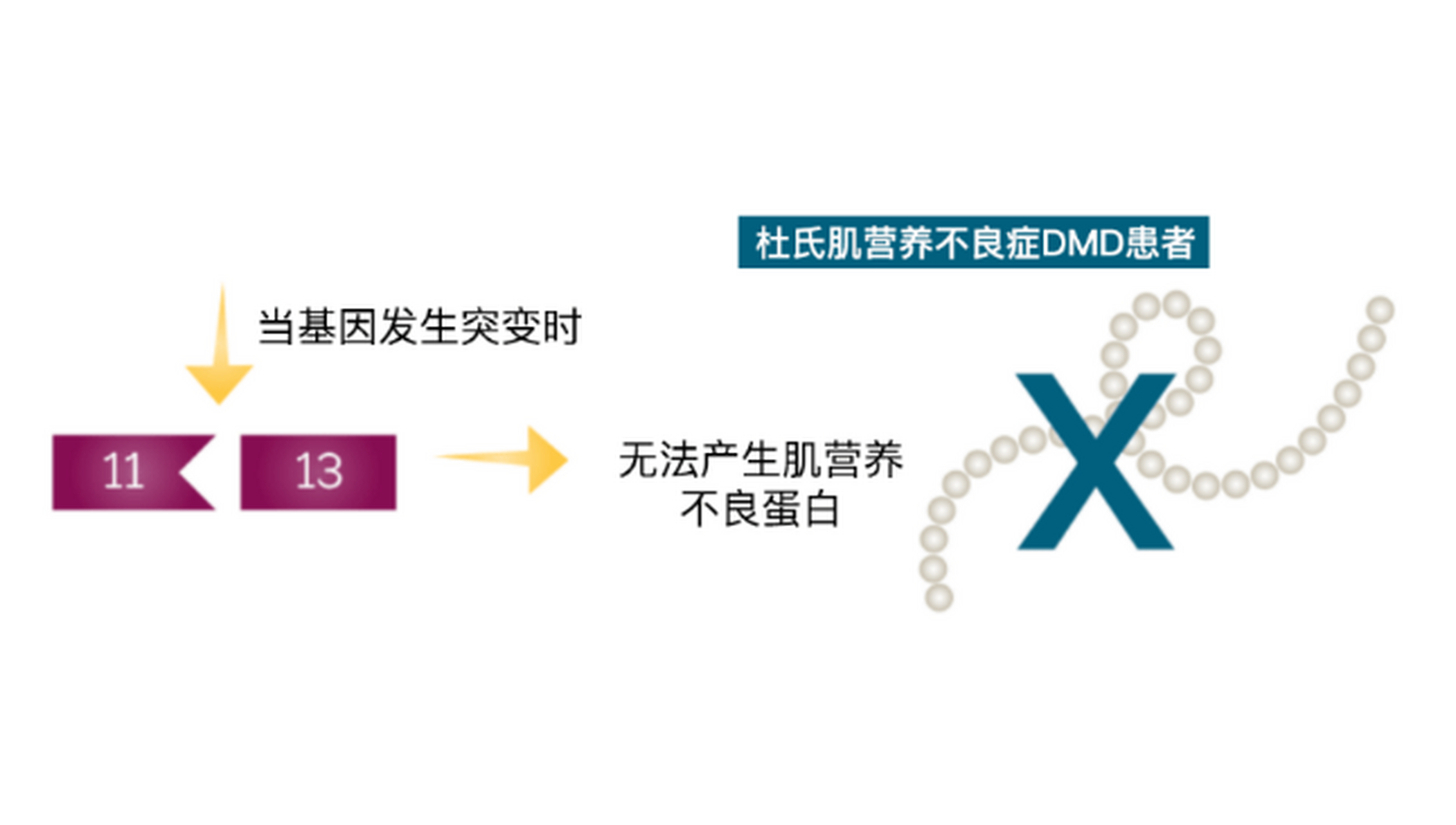 怎样断定是肌营养不良图片