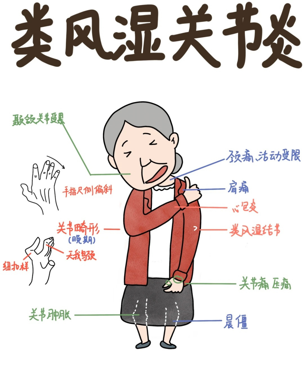 虽然类风湿病的病因尚不完全清楚,但是有些预防措施可以帮助减少患病