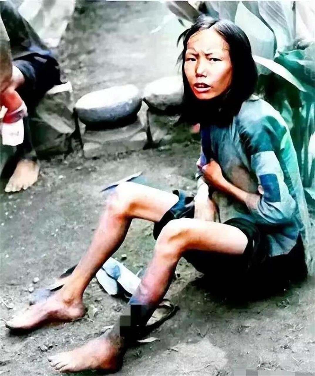 1942年,河南遭遇大灾,到处都是缺衣少食的灾民,照片中的这名妇女,骨瘦