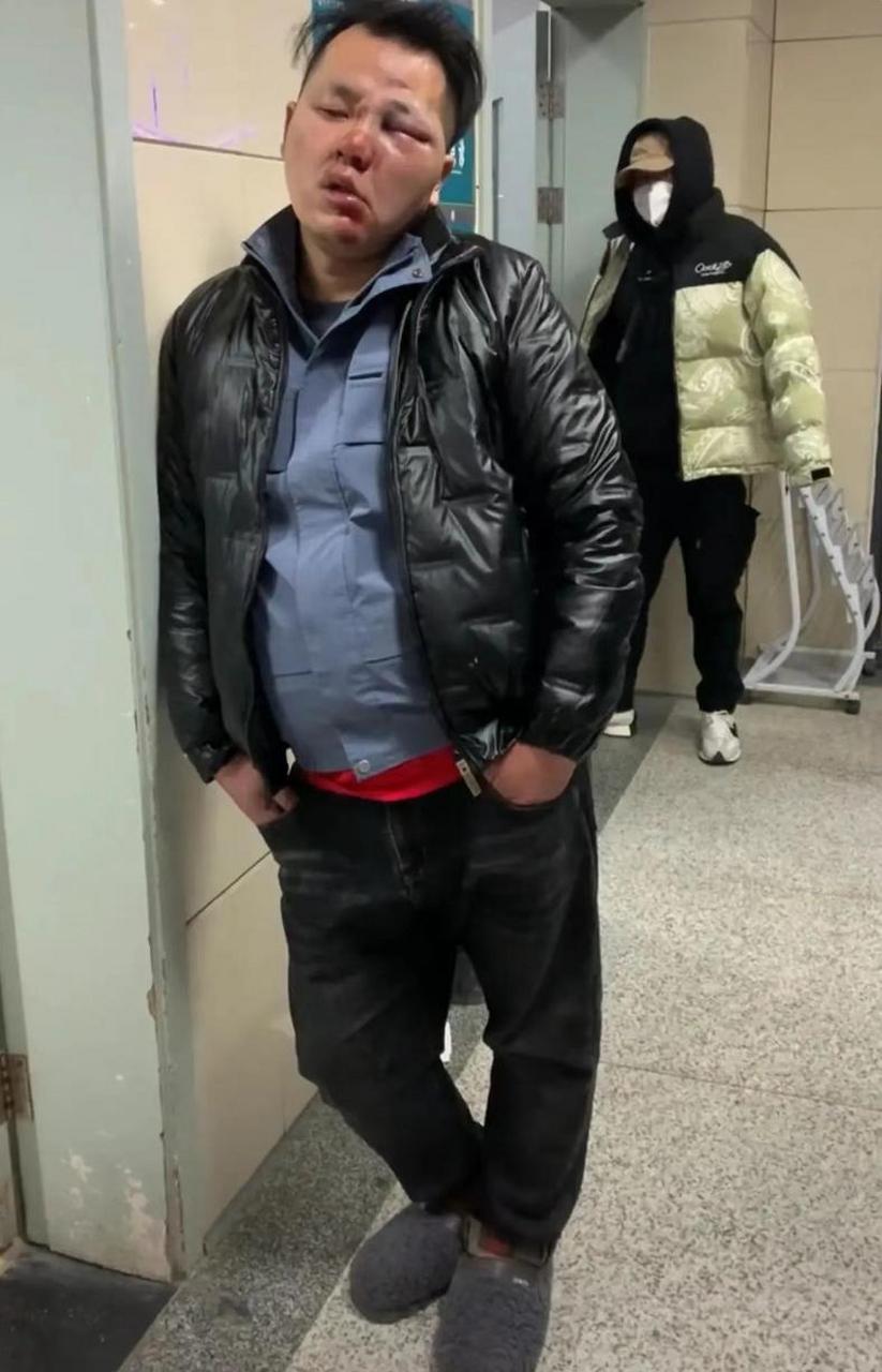 这是我见过画的最像鼻青脸肿的妆,什么时候去演艺圈?