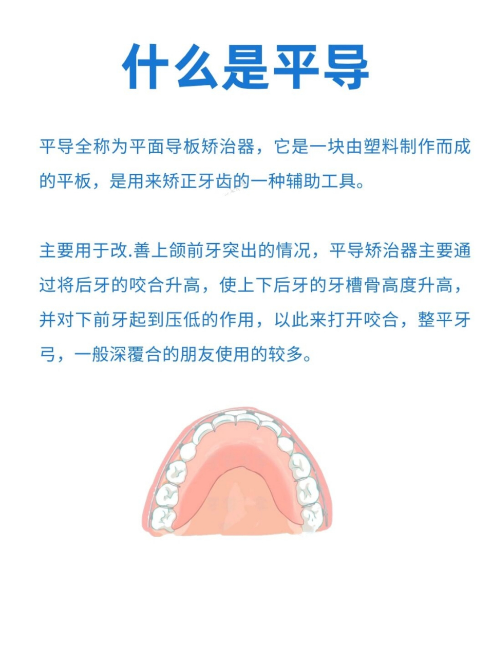 平面导板的作用图片