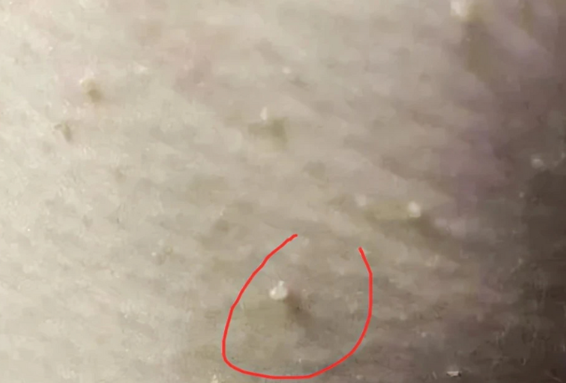 hpv也可能在暗中观察你哦～ 哨声响起,注意注意,身上长小疙瘩可能隐藏