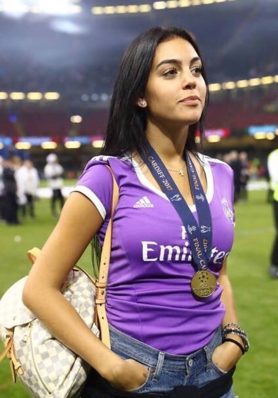 乔治娜整容不下12次7515包括丰臀,增唇等.