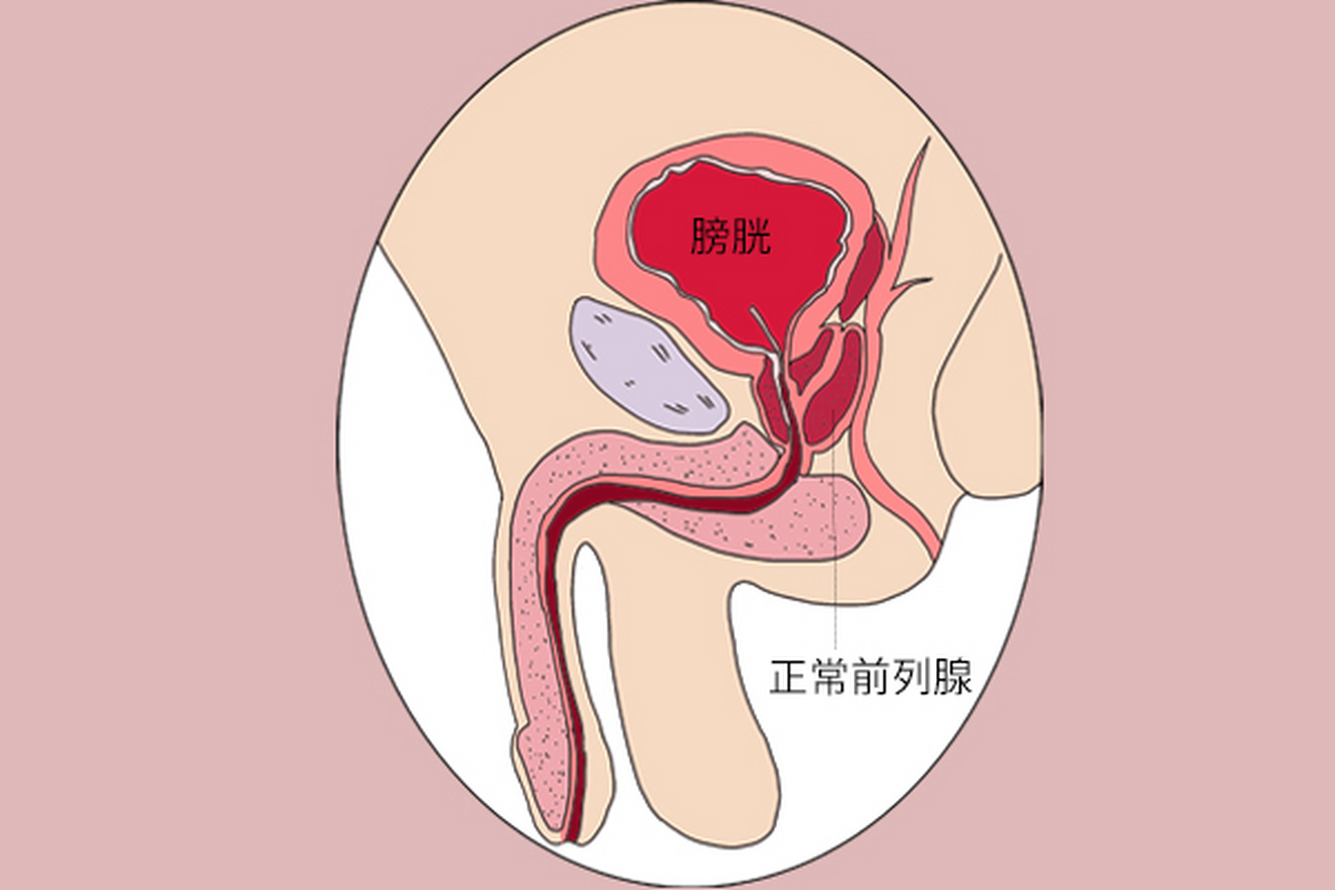 前列腺的位置正面照图片