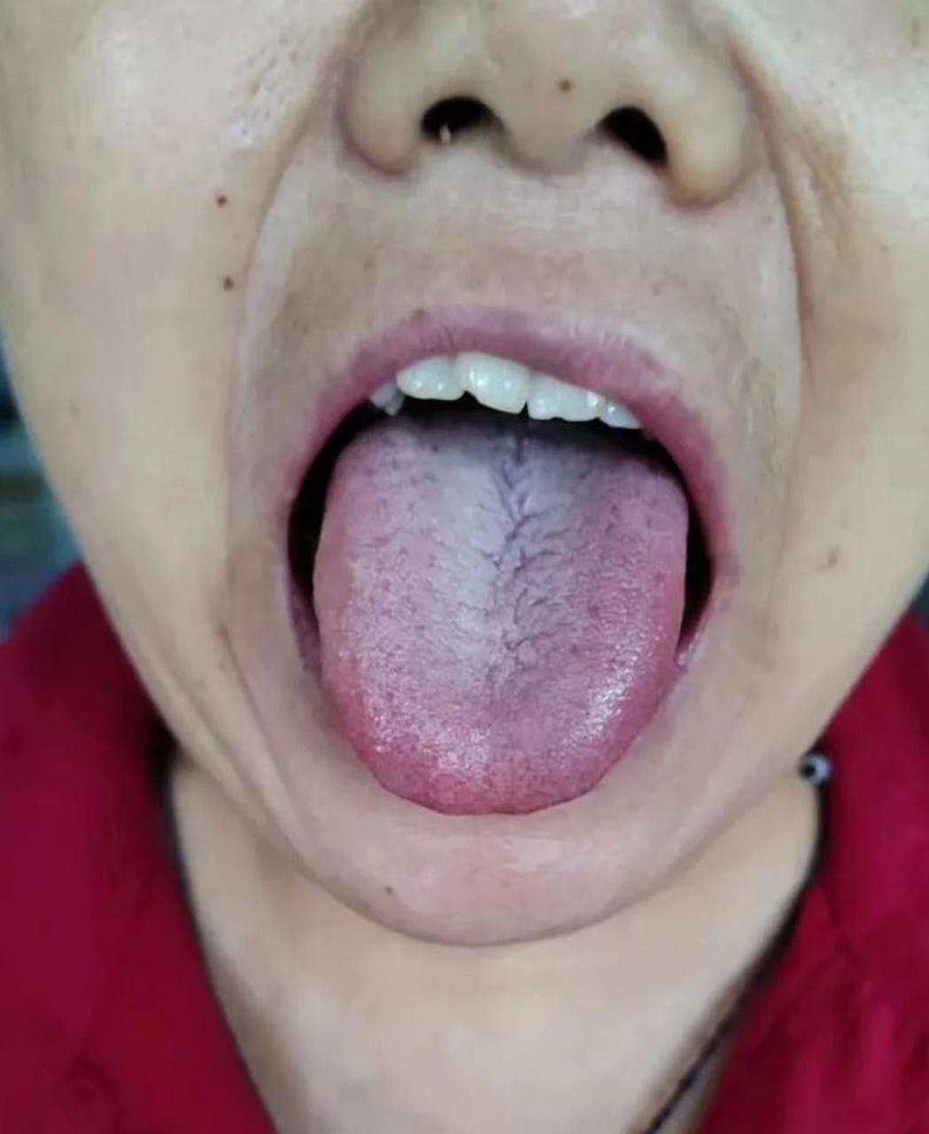 健康人的舌头图片侧面图片