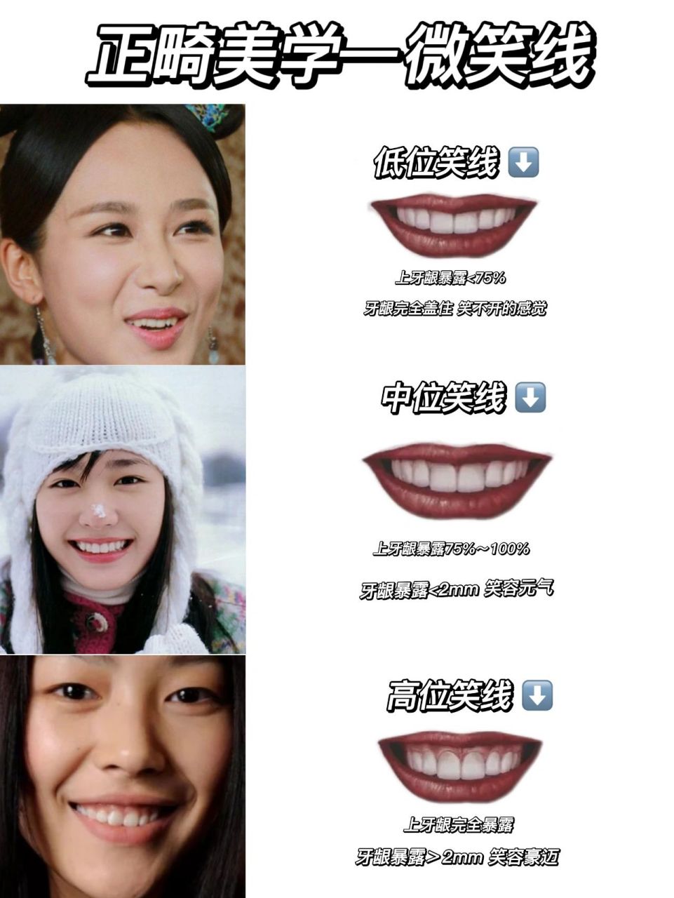 有的明星笑起来很好看,有些人笑起来却很好笑,造成这种笑容差的关键点