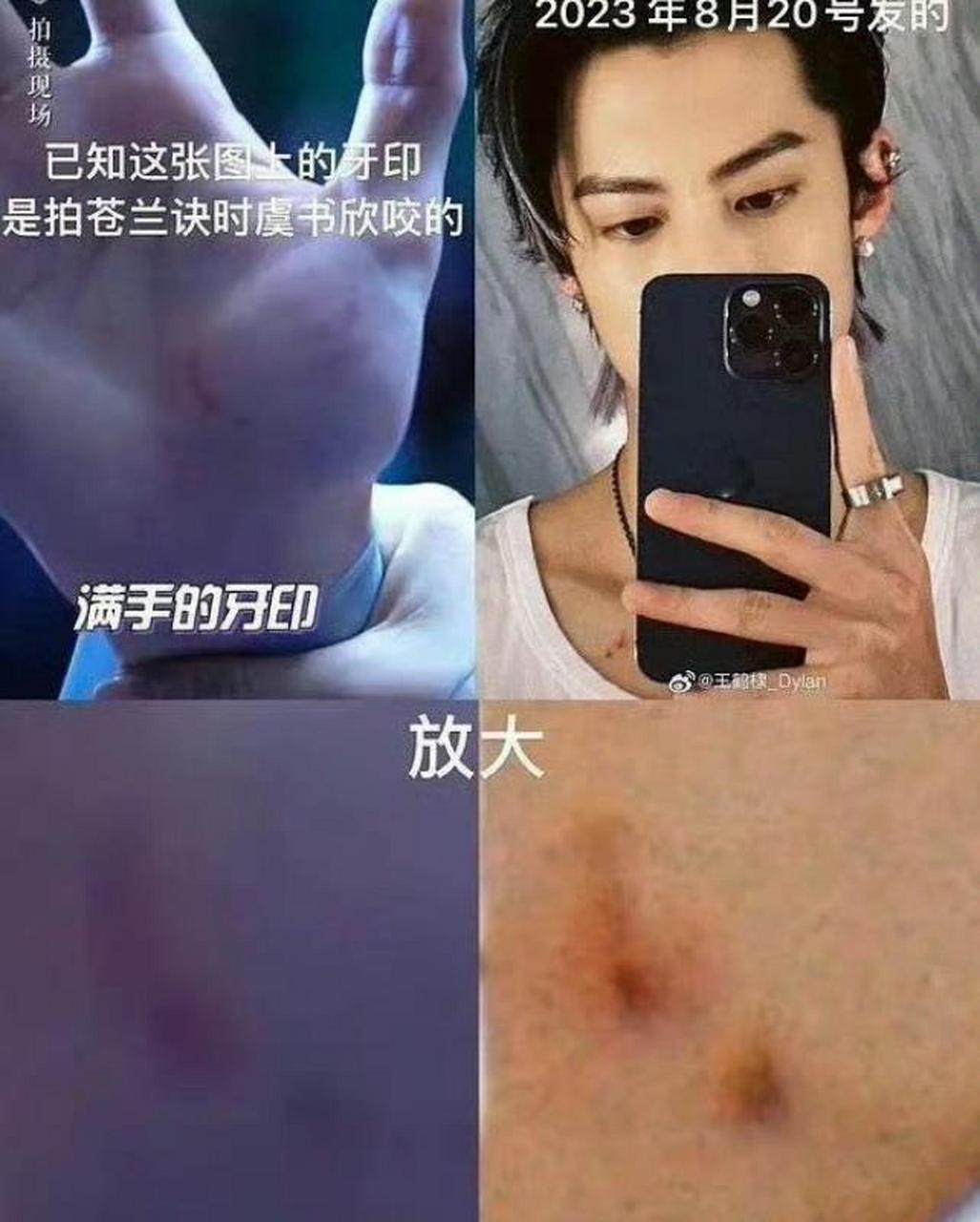 王鹤棣锁骨下面的红印引发了棣欣引力cp粉的分析,拿与苍兰诀时间