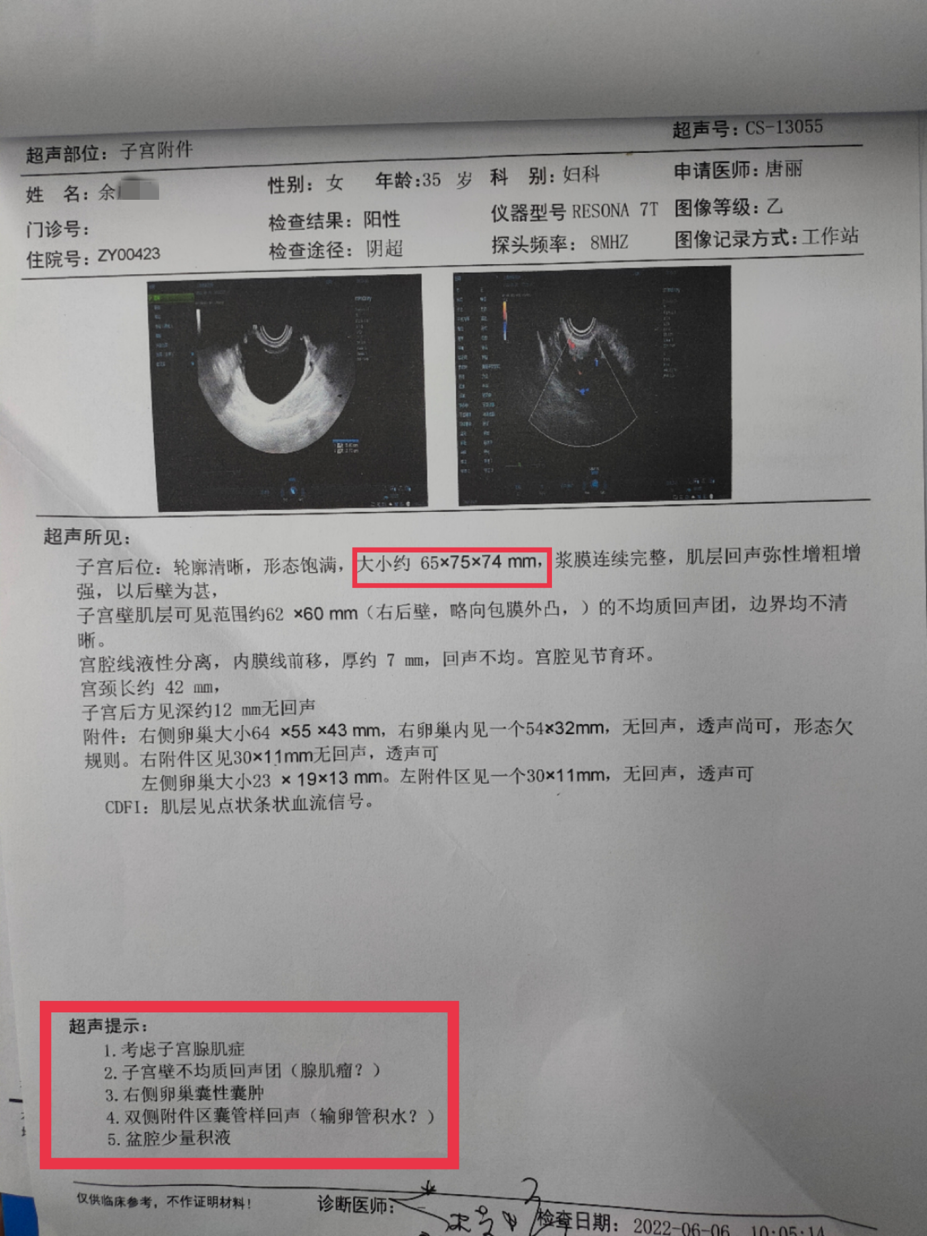 今年35岁痛经却有8年的时间期间口服药物效果不佳上曼月乐环也没用