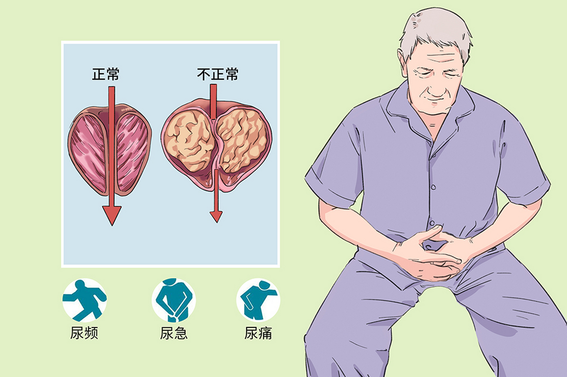 前列腺炎卡通图片