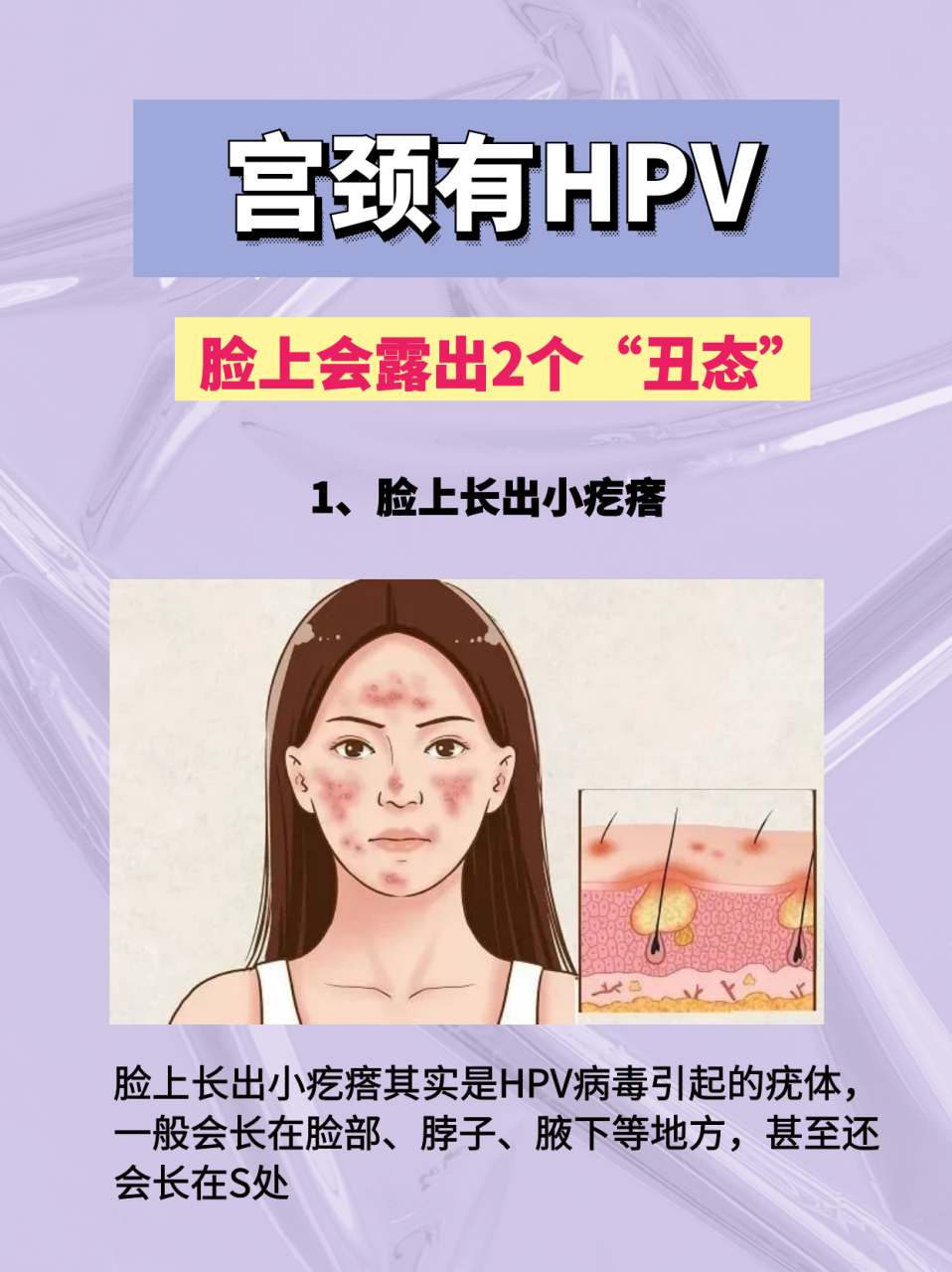 宮頸有hpv,臉部會先知,注意多留意是否出現2種