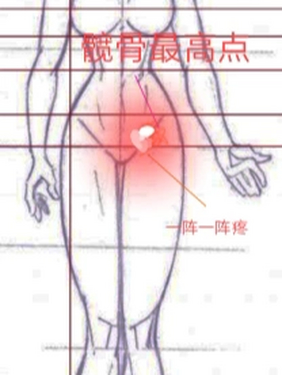 早孕4周 6天小腹左侧阵痛  1