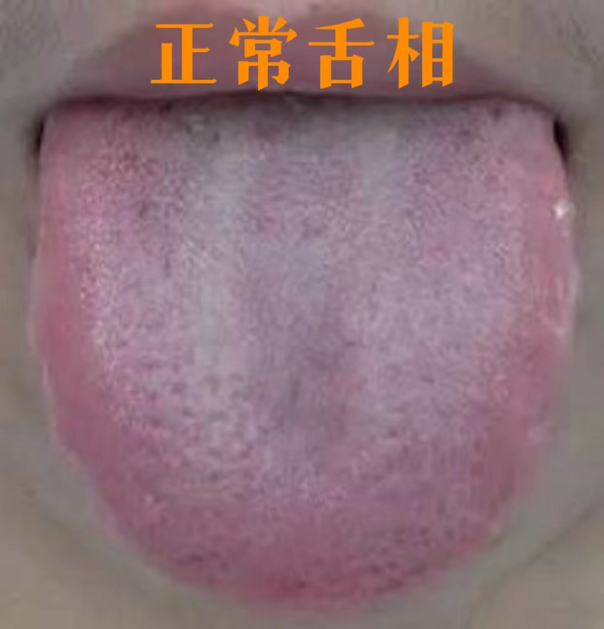 中医治疗,医生会叫你伸出舌头来看看,看的到底是什么呢?