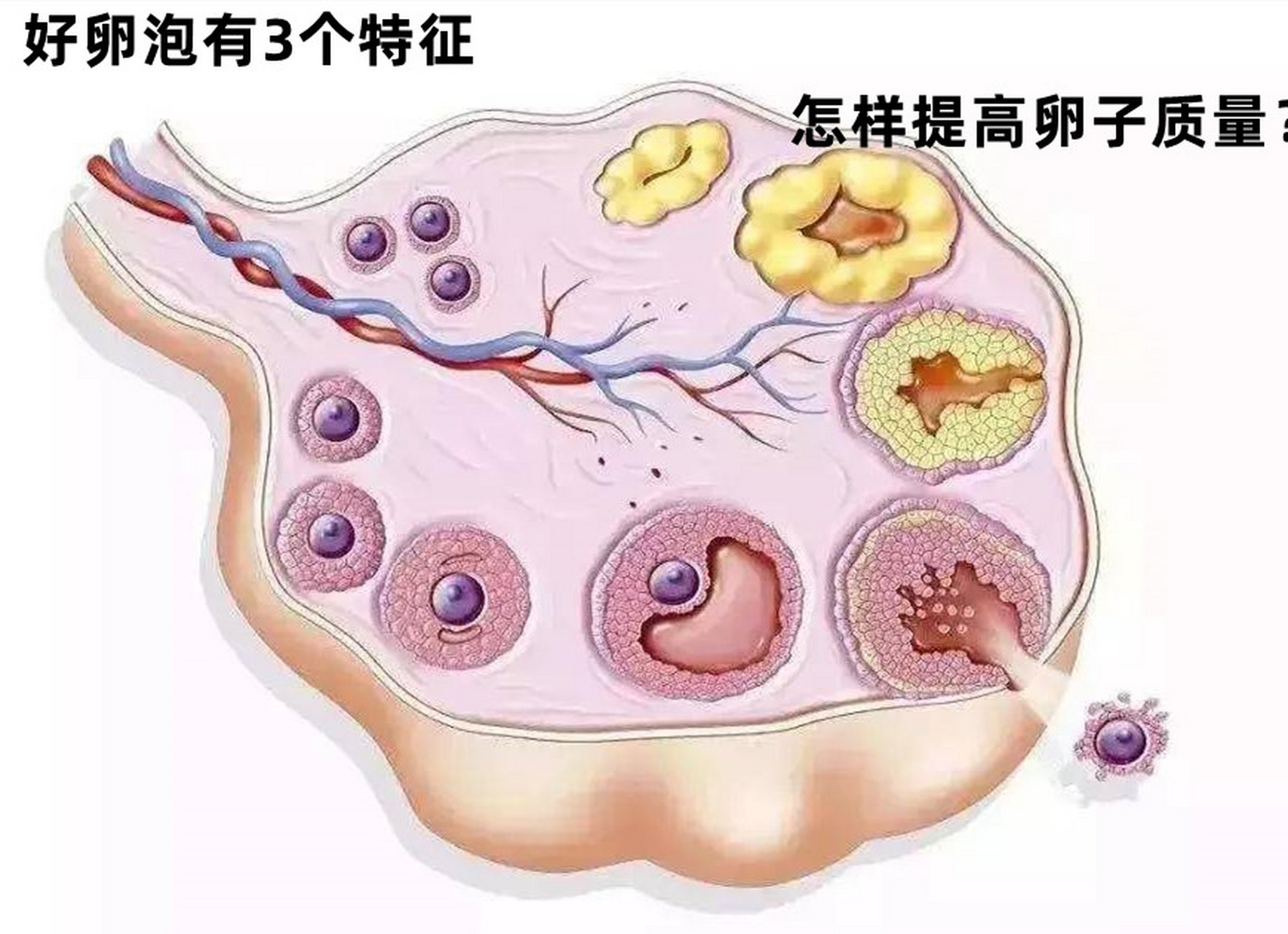 好卵泡有3个特征,怎样提高卵子质量?