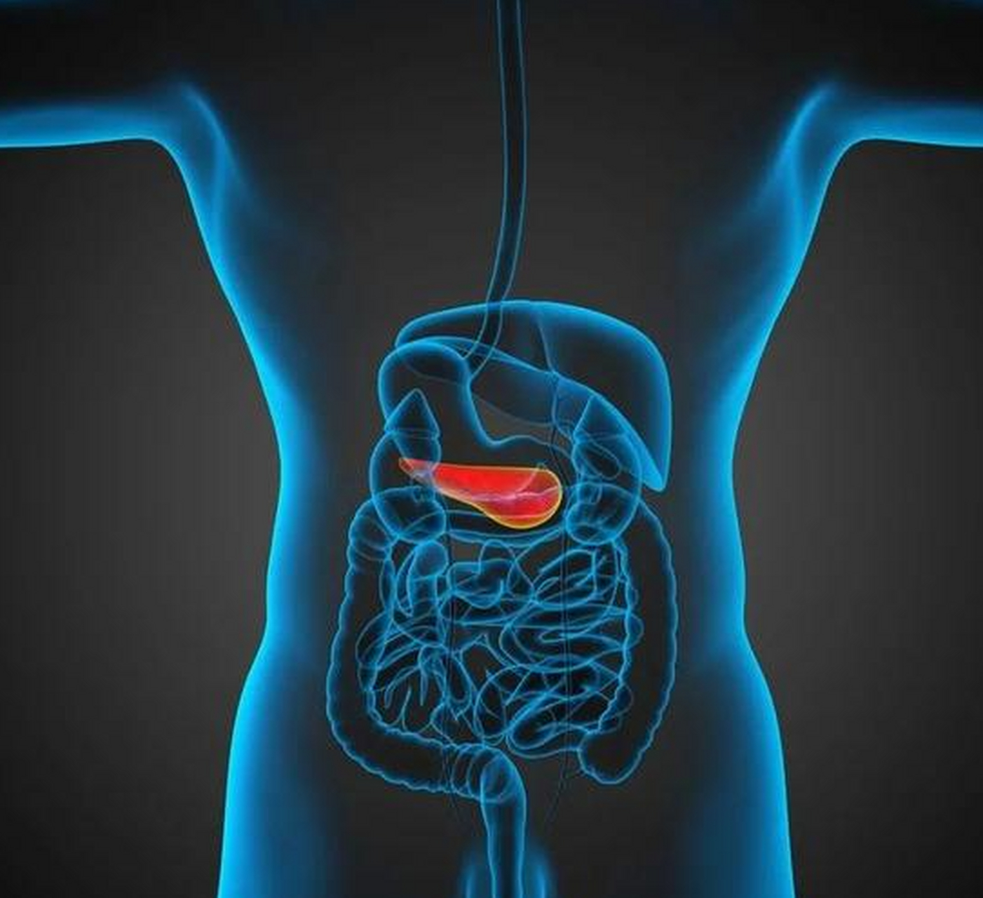 胆区疼痛的直接原因并非胆囊息肉或胆结石,而是胆囊炎.