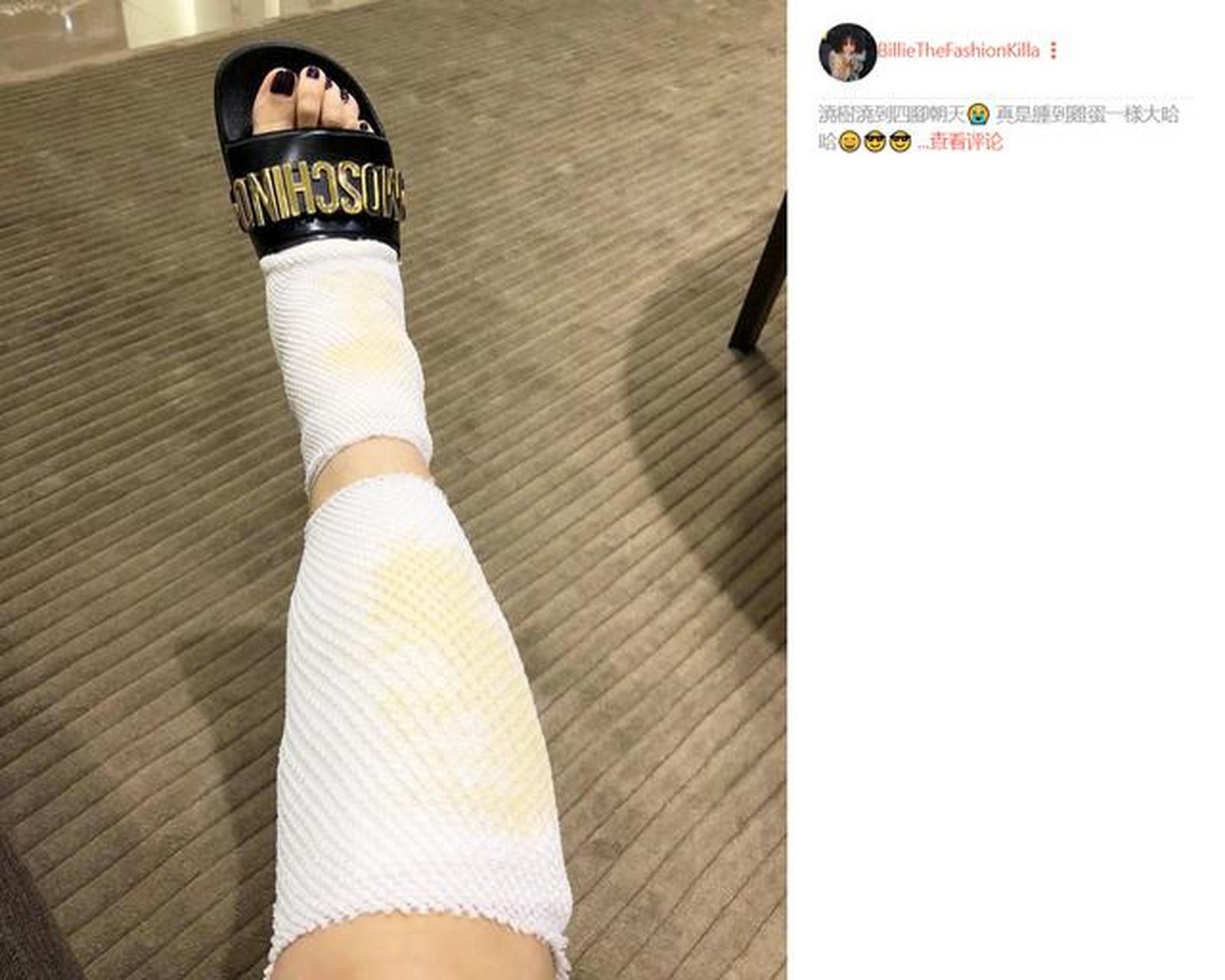 涓流计划# 近日,网上曝光了资深台湾歌手比莉的近况.