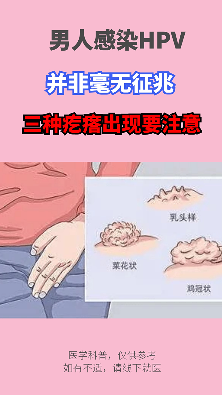 男人感染hpv,并非毫无征兆,三种疙瘩出现,早做检查 #hpv# #hpv感染