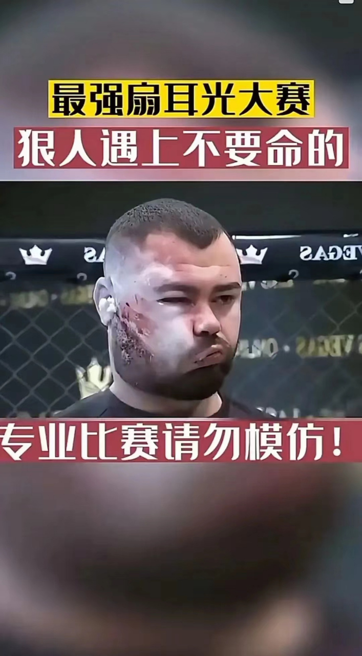 扇耳光大赛!?为什么会有这种反人类的比赛 下面图1的兄弟,嘴都被扇歪