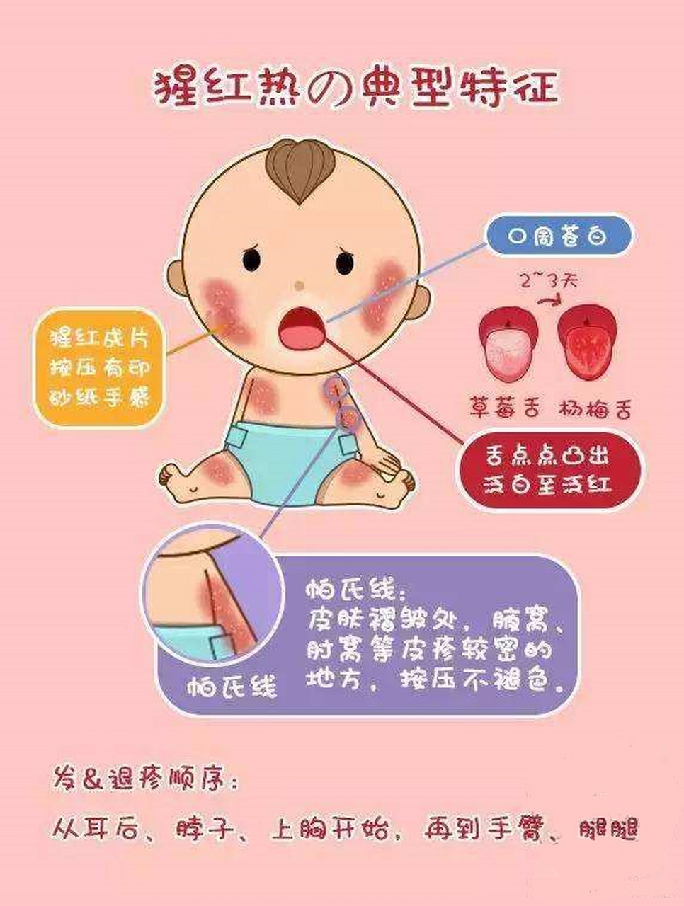 猩红热这个病有着三种分期,不同的分期有着不同的症状,前驱期患者会
