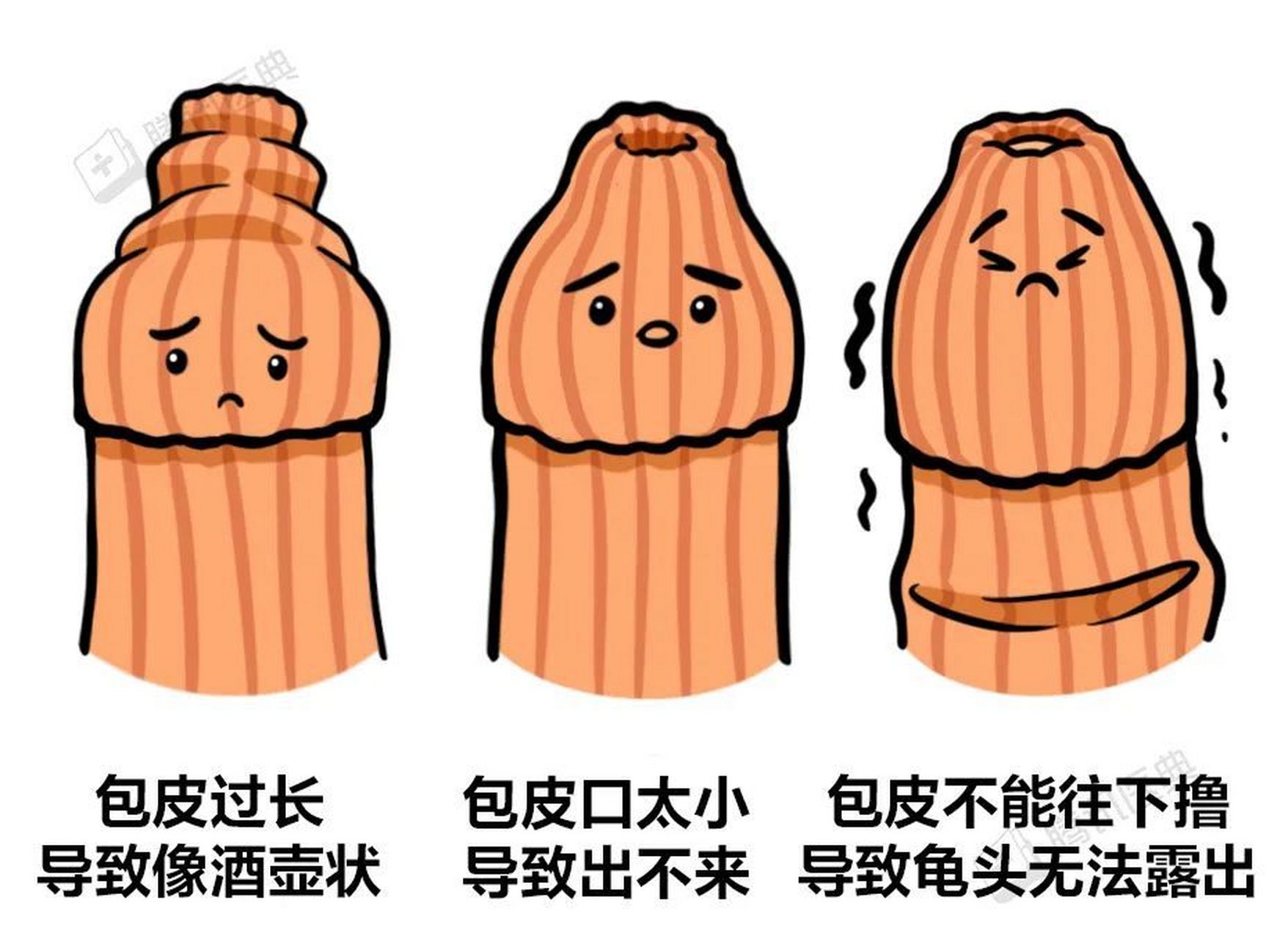 西安包皮手术医院排名# 西安看包皮过长好的医院「西安割包皮医院