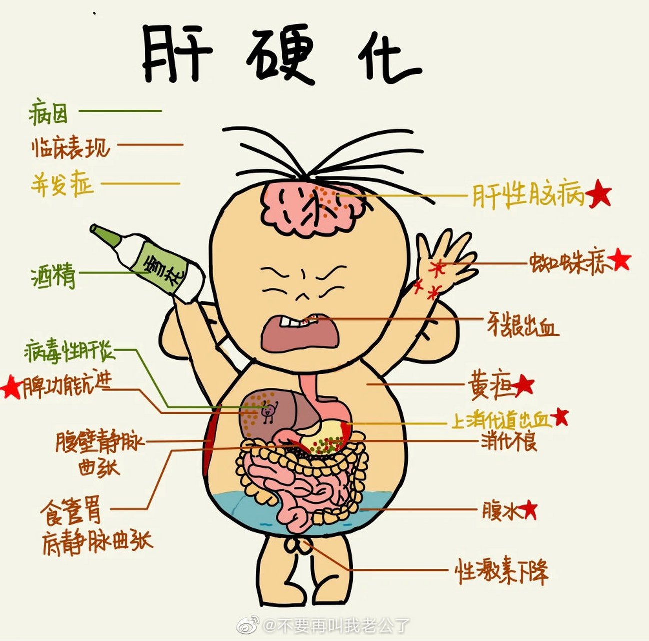 用两张图告诉你,肝硬化和慢性肝炎症状和临床表现以及并发症#肝硬化