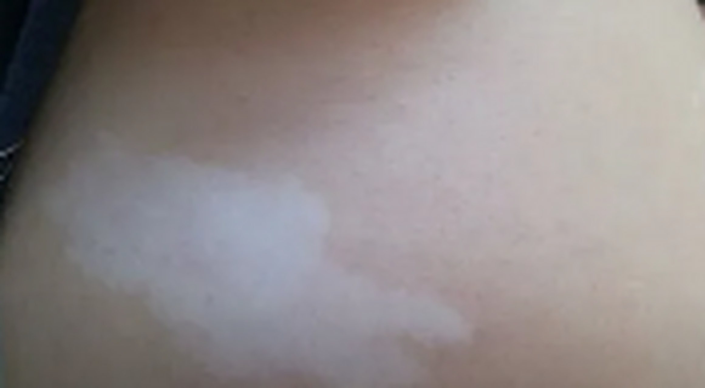 到底需不需要治呢?