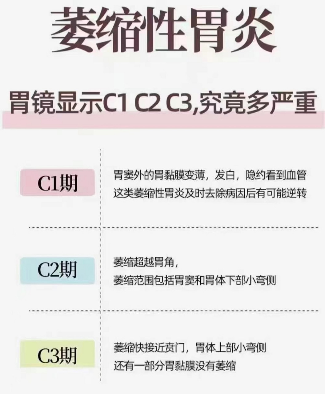 慢性萎缩性胃炎c2图片