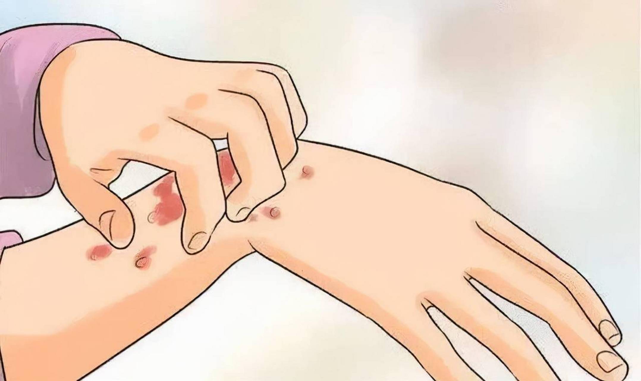 晒伤?晒黑?肿瘤?