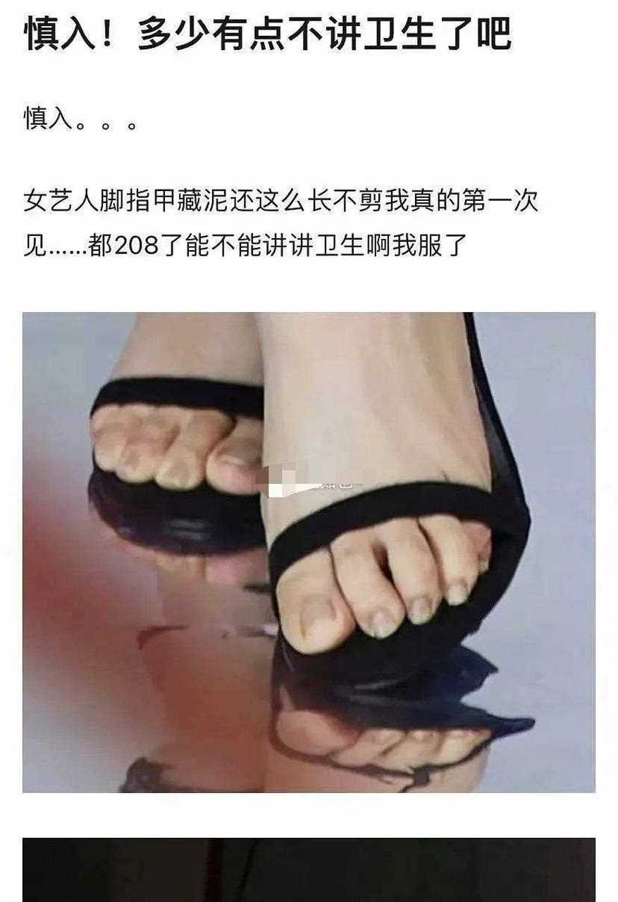 为什么白鹿拍杂志脚趾甲这么长也不想着剪一下,而且能明显看出指甲里